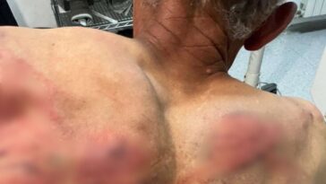 Kosovska policija odvela Srbina u šumu, vezali ga za drvo i prebili crevom
